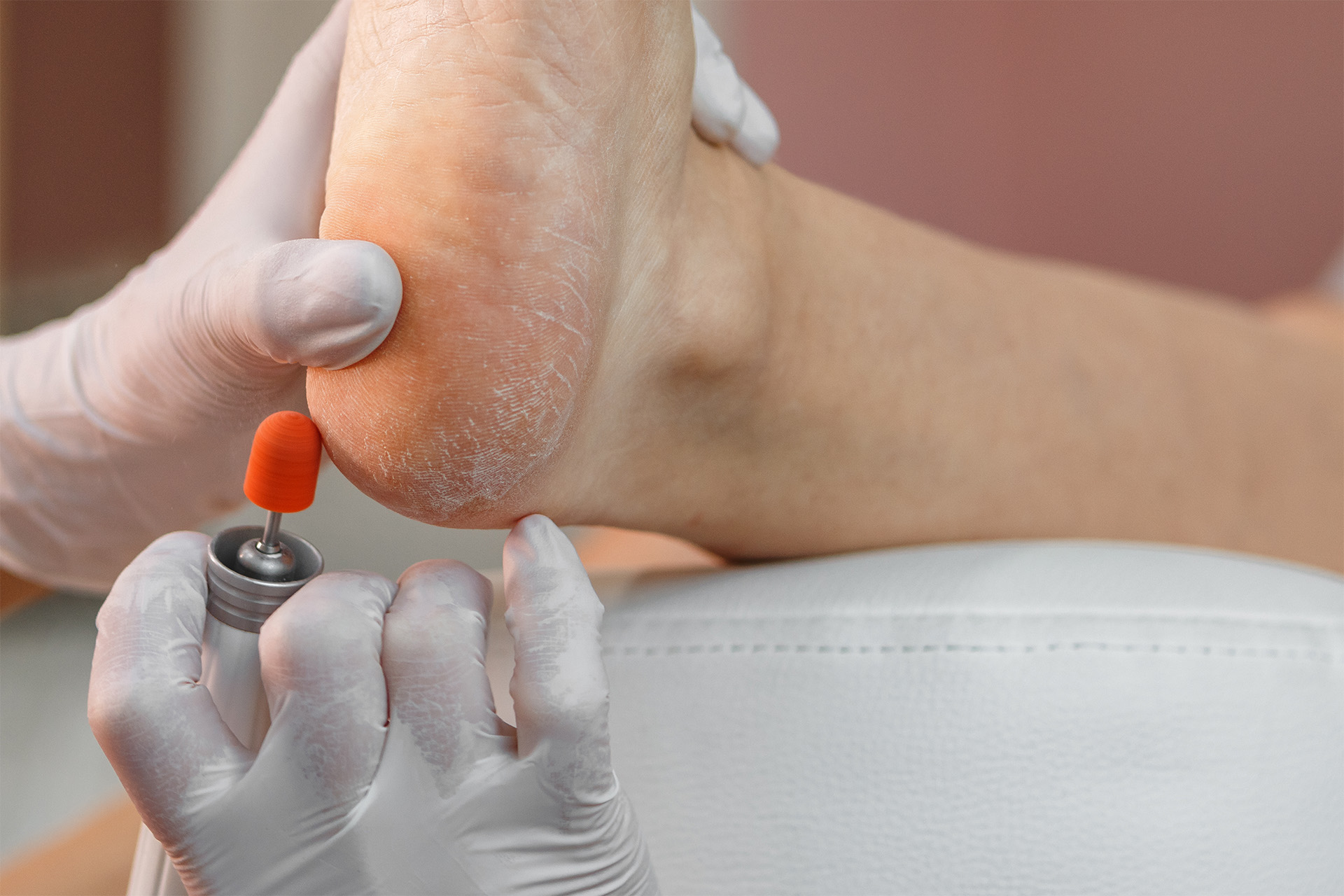 pedicure medisch